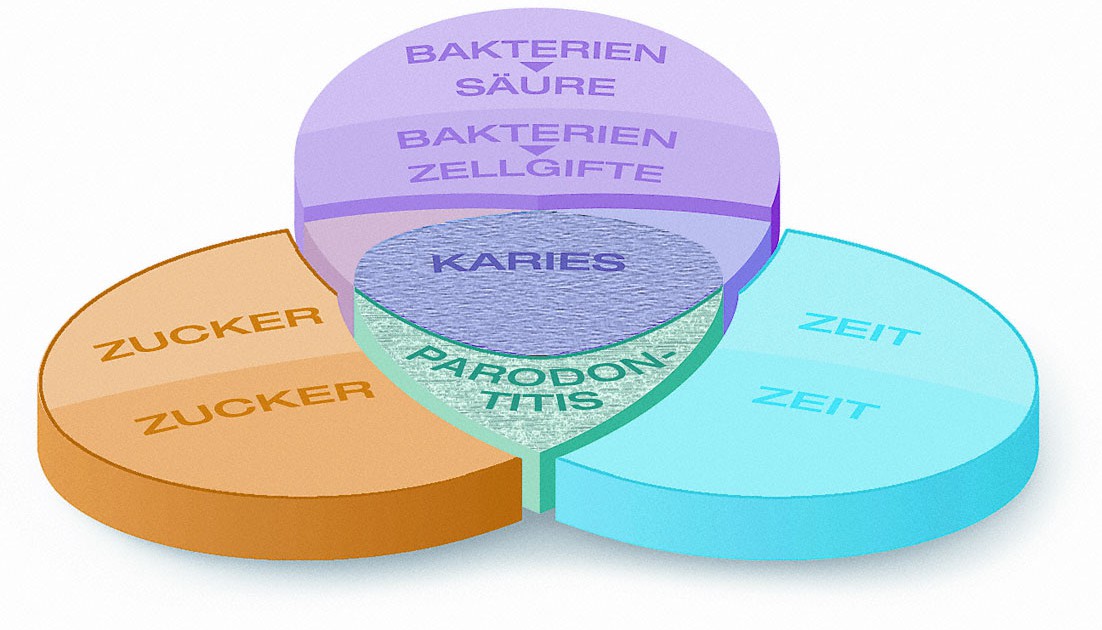 Entstehung von Karies und Zahnfleischentzündungen